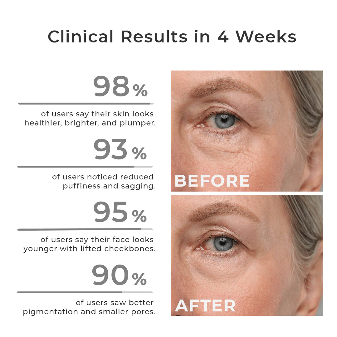 "GlowLift Facial Cupping System"